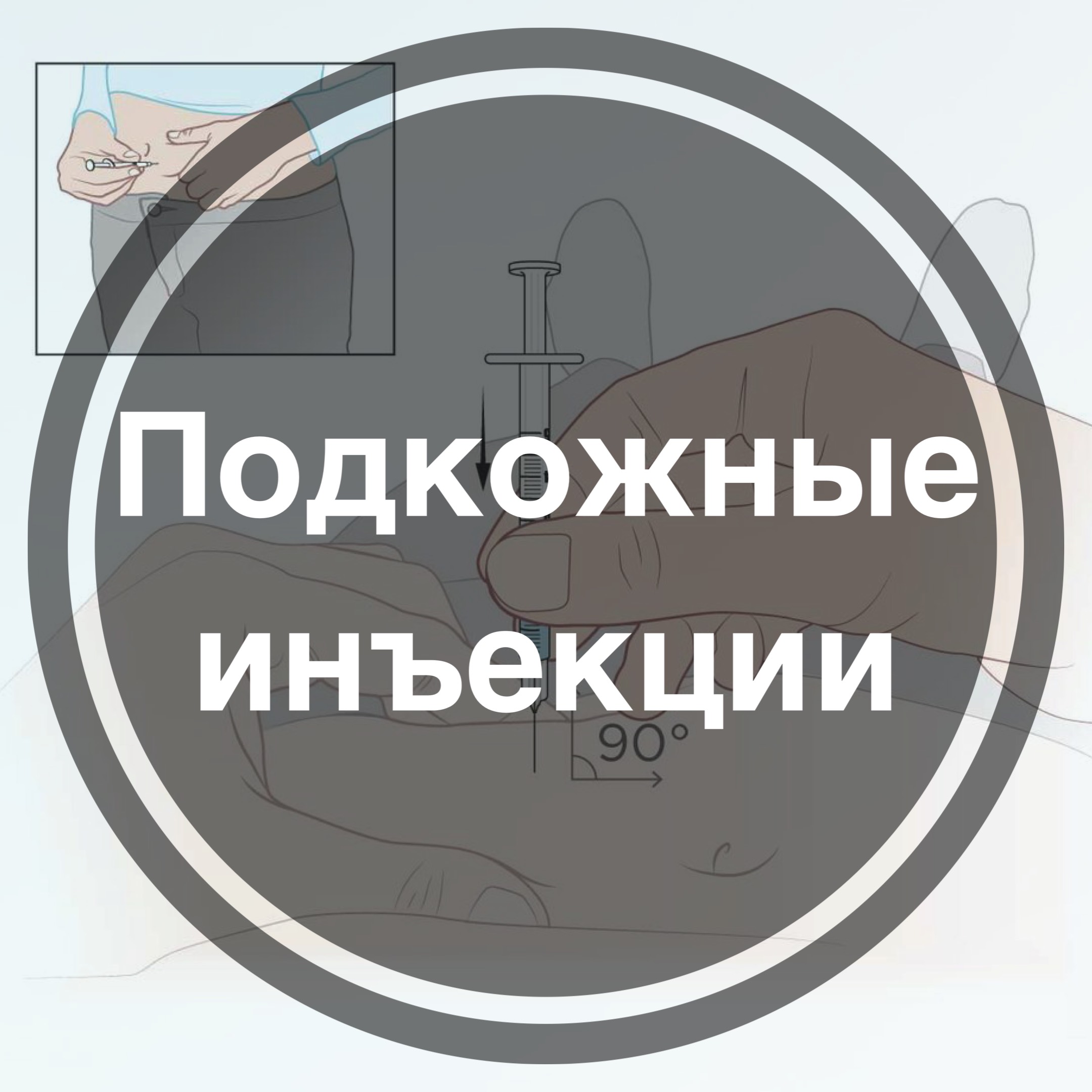 Подкожная инъекция: техника выполнения